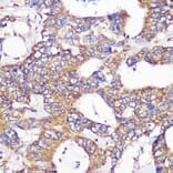 Immunohistochemistry - Anti-GCP6 Antibody (A88879) - Antibodies.com