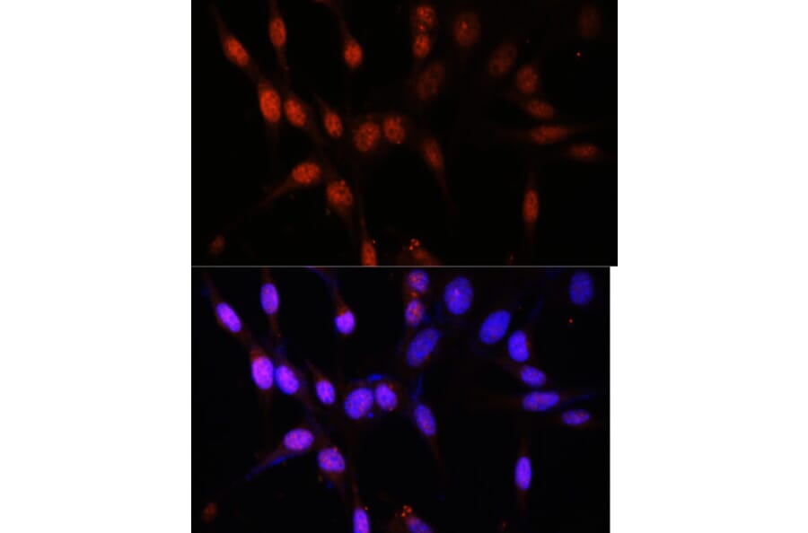 Immunofluorescence - Anti-Histone acetyltransferase MYST3/MOZ Antibody (A88880) - Antibodies.com