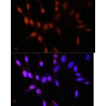 Immunofluorescence - Anti-Histone acetyltransferase MYST3/MOZ Antibody (A88880) - Antibodies.com