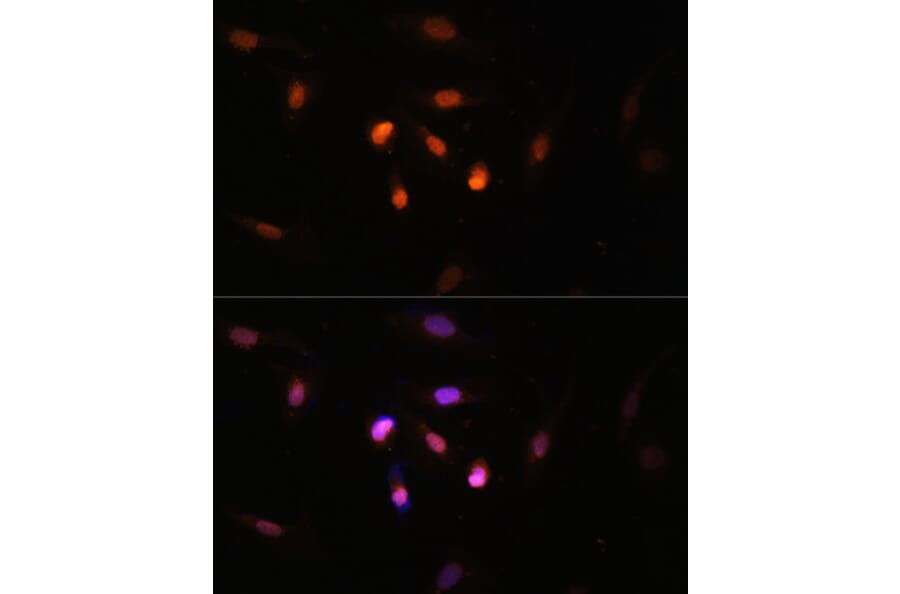 Immunofluorescence - Anti-Histone acetyltransferase MYST3/MOZ Antibody (A88880) - Antibodies.com