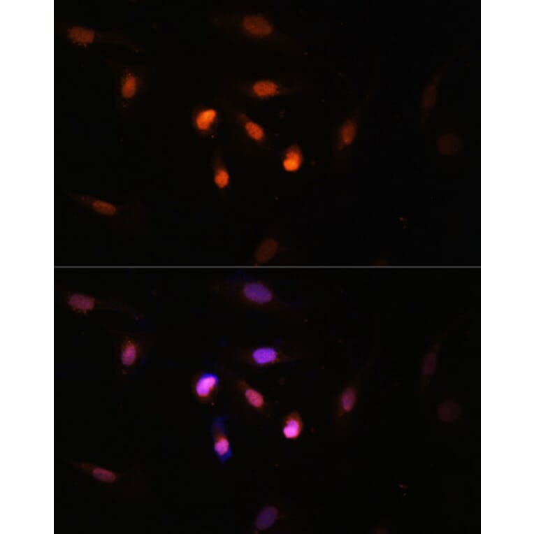 Immunofluorescence - Anti-Histone acetyltransferase MYST3/MOZ Antibody (A88880) - Antibodies.com