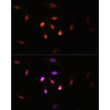 Immunofluorescence - Anti-Histone acetyltransferase MYST3/MOZ Antibody (A88880) - Antibodies.com
