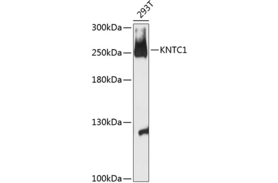Western Blot - Anti-Kinetochore Antibody (A88881) - Antibodies.com