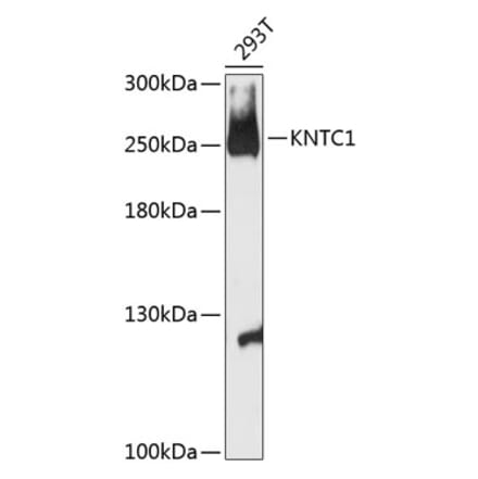 Western Blot - Anti-Kinetochore Antibody (A88881) - Antibodies.com