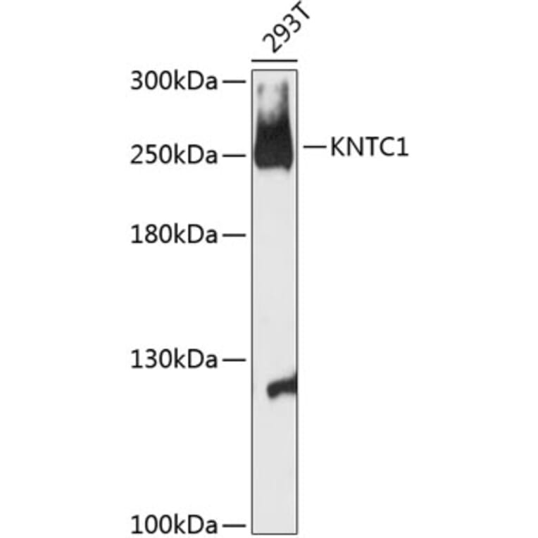 Western Blot - Anti-Kinetochore Antibody (A88881) - Antibodies.com