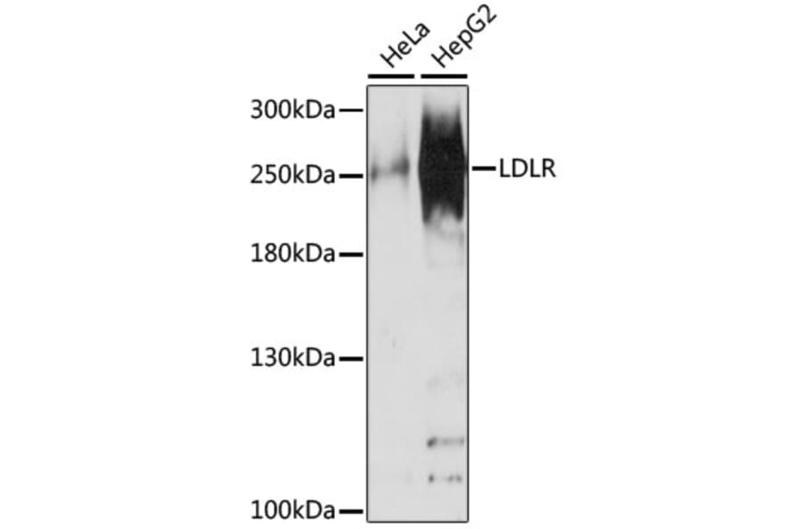Western Blot - Anti-NUP210 Antibody (A16676) - Antibodies.com