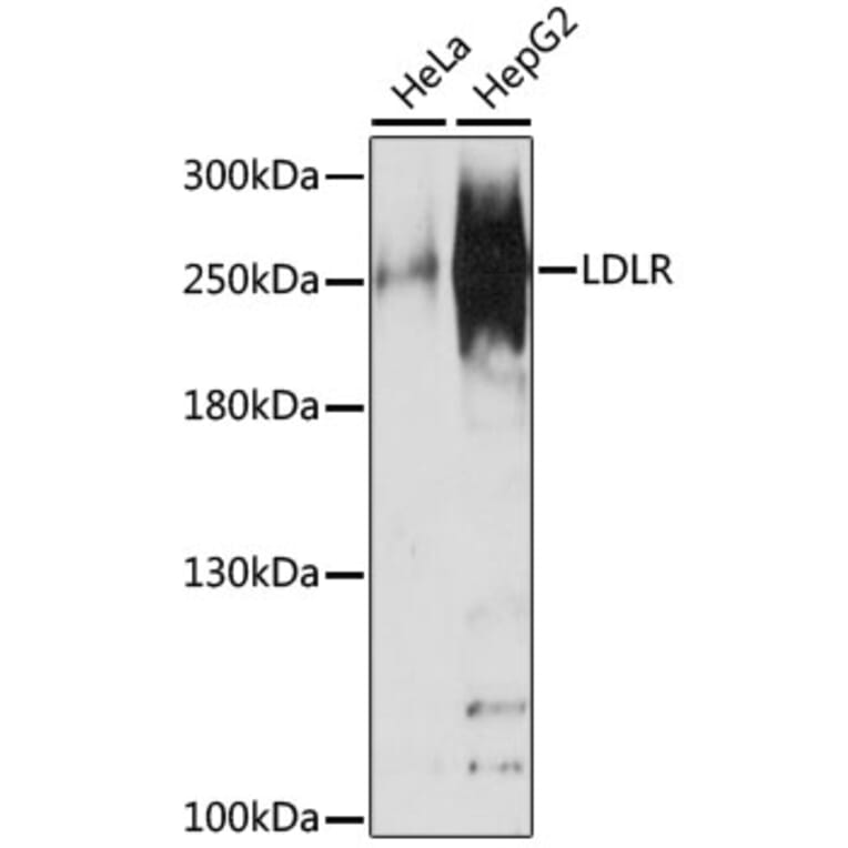 Western Blot - Anti-NUP210 Antibody (A16676) - Antibodies.com