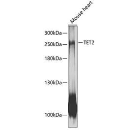 Western Blot - Anti-Tet2 Antibody (A88883) - Antibodies.com
