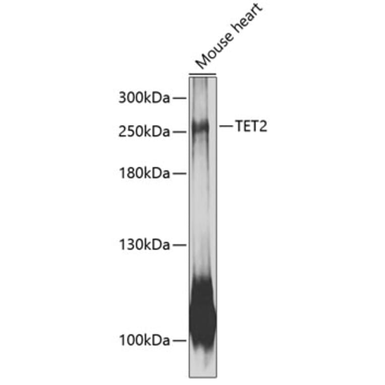 Western Blot - Anti-Tet2 Antibody (A88883) - Antibodies.com
