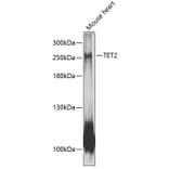 Western Blot - Anti-Tet2 Antibody (A88883) - Antibodies.com