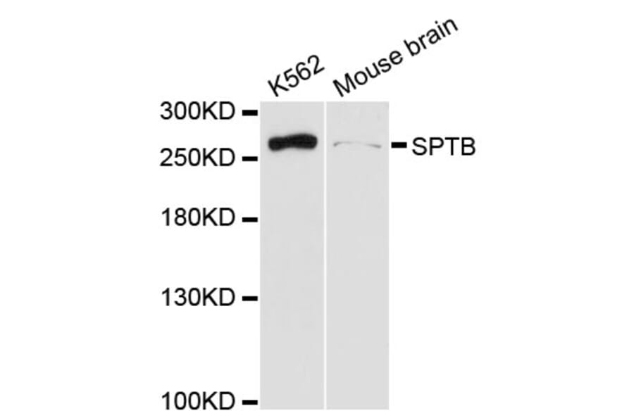 Western Blot - Anti-SPTB Antibody (A13048) - Antibodies.com