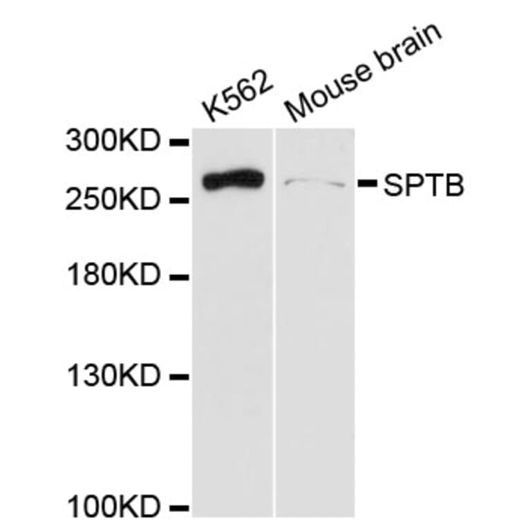 Western Blot - Anti-SPTB Antibody (A13048) - Antibodies.com