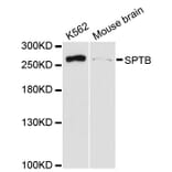 Western Blot - Anti-SPTB Antibody (A13048) - Antibodies.com