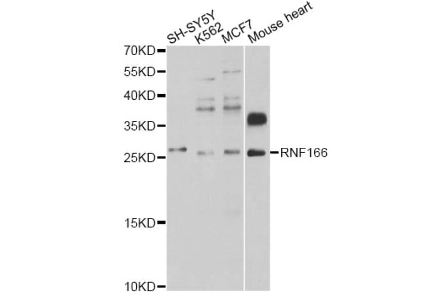 Western Blot - Anti-RNF166 Antibody (A12607) - Antibodies.com