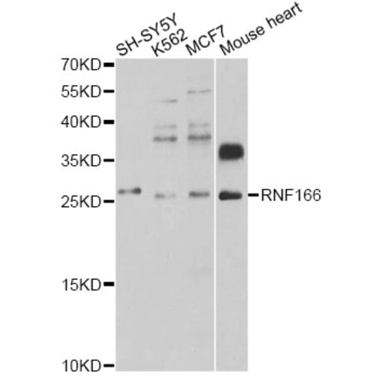 Western Blot - Anti-RNF166 Antibody (A12607) - Antibodies.com