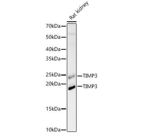 Western Blot - Anti-TIMP3 Antibody (A88886) - Antibodies.com