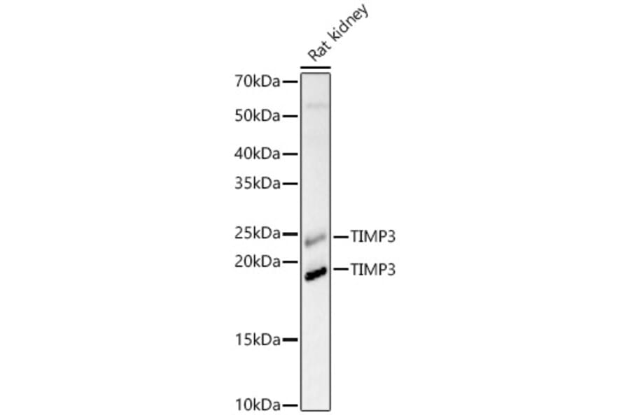 Western Blot - Anti-TIMP3 Antibody (A88886) - Antibodies.com