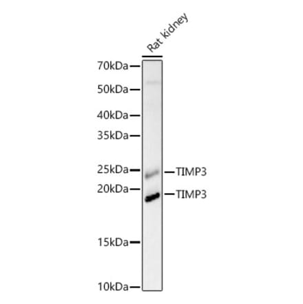 Western Blot - Anti-TIMP3 Antibody (A88886) - Antibodies.com