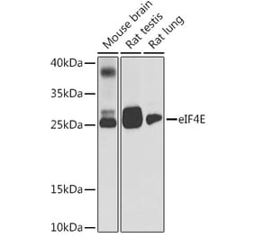 Western Blot - Anti-eIF4E Antibody (A88887) - Antibodies.com