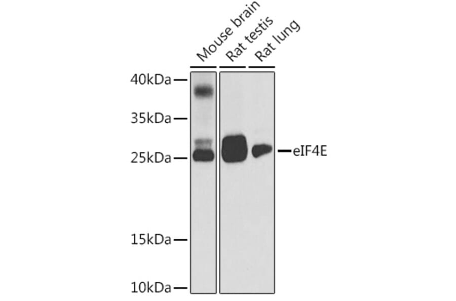 Western Blot - Anti-eIF4E Antibody (A88887) - Antibodies.com