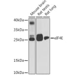 Western Blot - Anti-eIF4E Antibody (A88887) - Antibodies.com
