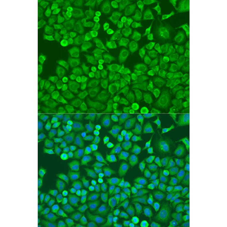 Immunofluorescence - Anti-eIF4E Antibody (A88887) - Antibodies.com