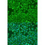 Immunofluorescence - Anti-eIF4E Antibody (A88887) - Antibodies.com