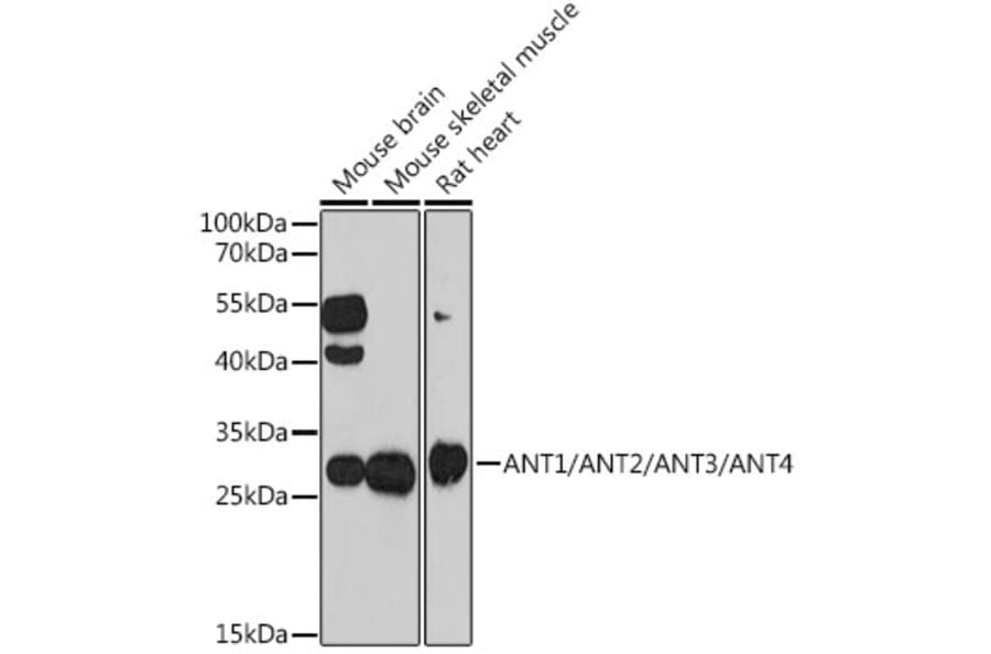 Western Blot - Anti-ANT 1 +ANT2 + ANT3/SLC25A6 + ANT4 Antibody (A88888) - Antibodies.com