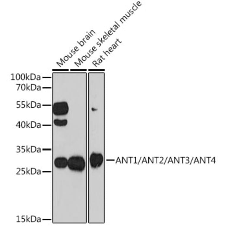 Western Blot - Anti-ANT 1 +ANT2 + ANT3/SLC25A6 + ANT4 Antibody (A88888) - Antibodies.com