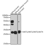 Western Blot - Anti-ANT 1 +ANT2 + ANT3/SLC25A6 + ANT4 Antibody (A88888) - Antibodies.com