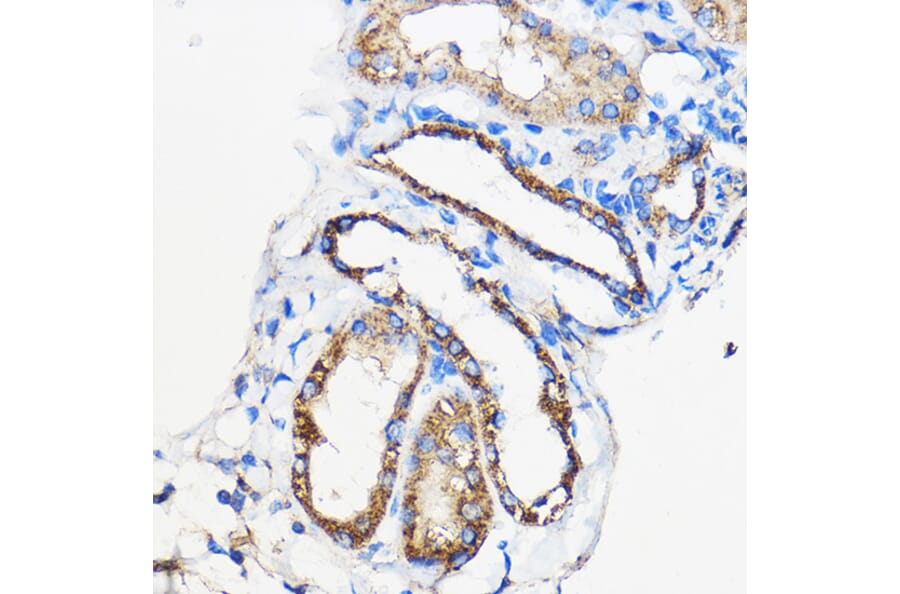 Immunohistochemistry - Anti-ANT 1 +ANT2 + ANT3/SLC25A6 + ANT4 Antibody (A88888) - Antibodies.com