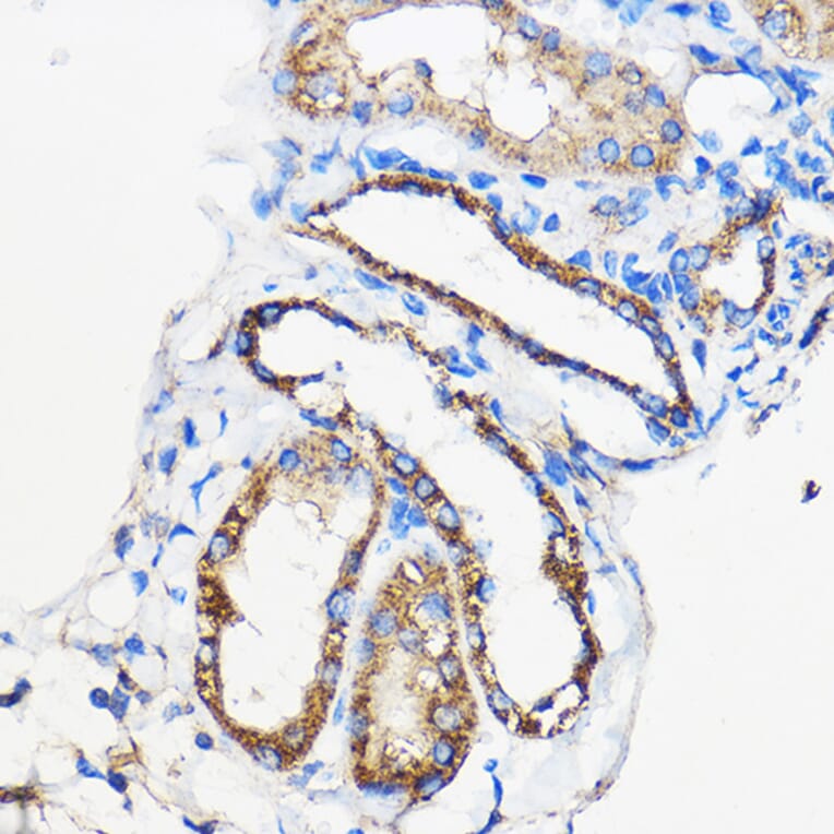 Immunohistochemistry - Anti-ANT 1 +ANT2 + ANT3/SLC25A6 + ANT4 Antibody (A88888) - Antibodies.com