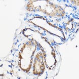 Immunohistochemistry - Anti-ANT 1 +ANT2 + ANT3/SLC25A6 + ANT4 Antibody (A88888) - Antibodies.com