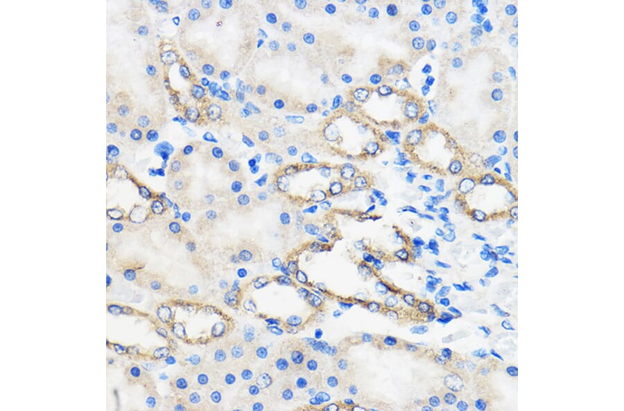 Immunohistochemistry - Anti-ANT 1 +ANT2 + ANT3/SLC25A6 + ANT4 Antibody (A88888) - Antibodies.com