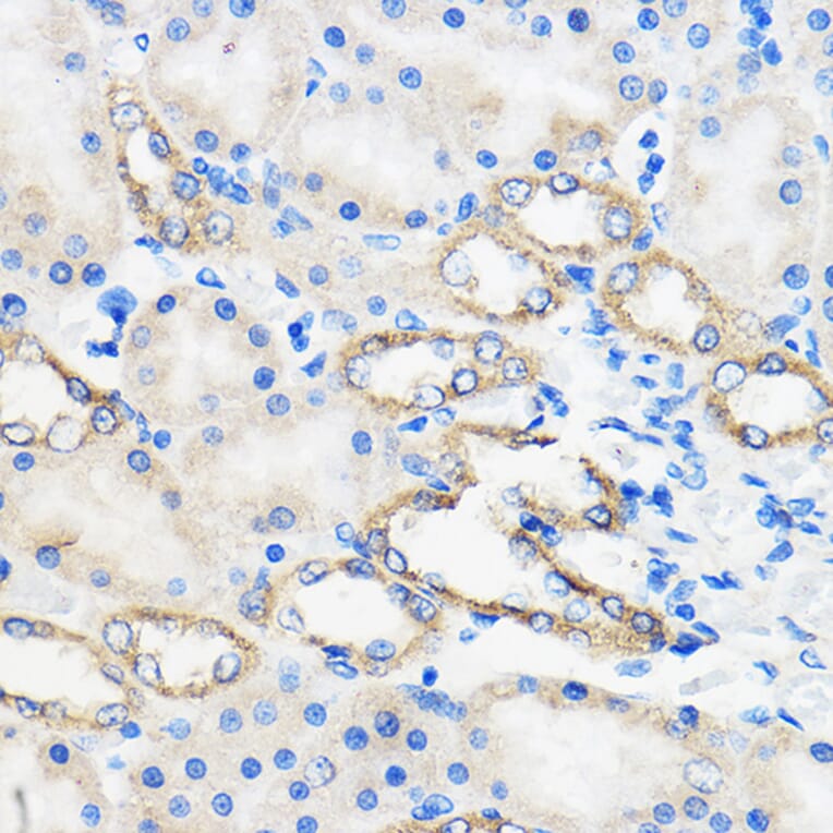 Immunohistochemistry - Anti-ANT 1 +ANT2 + ANT3/SLC25A6 + ANT4 Antibody (A88888) - Antibodies.com