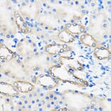 Immunohistochemistry - Anti-ANT 1 +ANT2 + ANT3/SLC25A6 + ANT4 Antibody (A88888) - Antibodies.com
