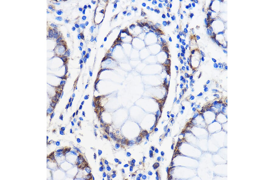 Immunohistochemistry - Anti-ANT 1 +ANT2 + ANT3/SLC25A6 + ANT4 Antibody (A88888) - Antibodies.com