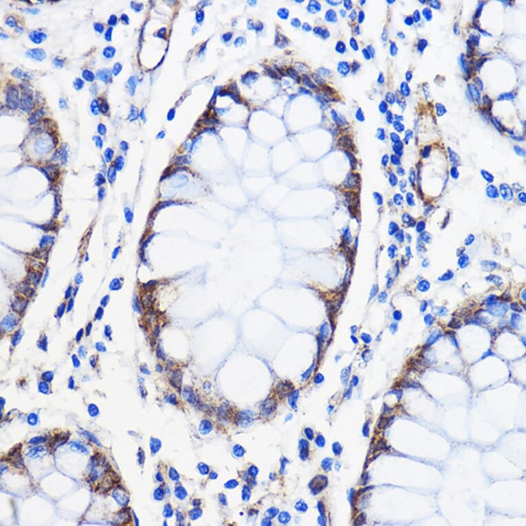 Immunohistochemistry - Anti-ANT 1 +ANT2 + ANT3/SLC25A6 + ANT4 Antibody (A88888) - Antibodies.com