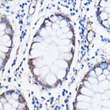Immunohistochemistry - Anti-ANT 1 +ANT2 + ANT3/SLC25A6 + ANT4 Antibody (A88888) - Antibodies.com