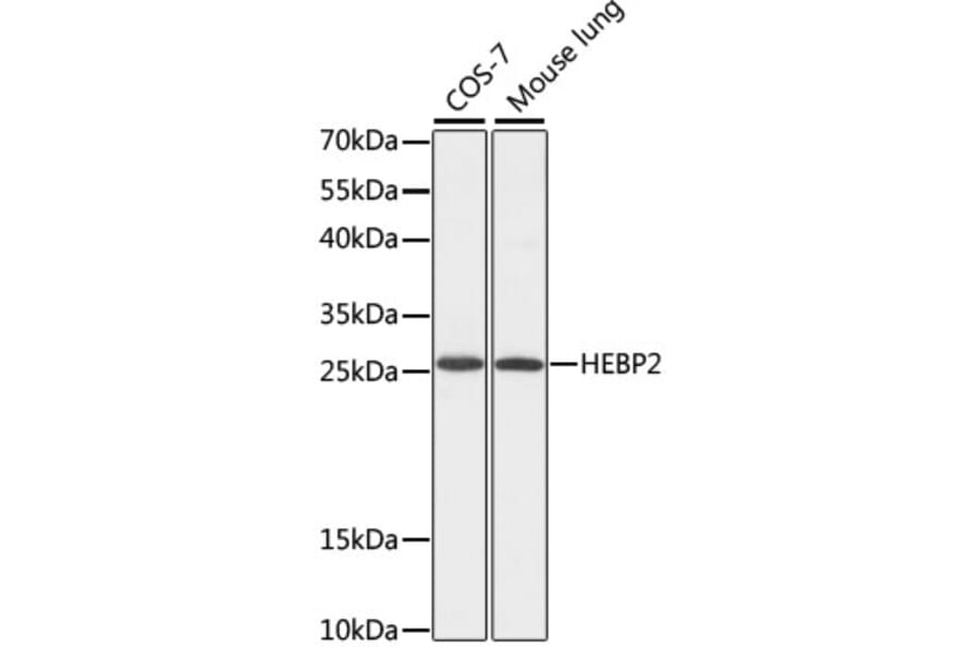Western Blot - Anti-HEBP2 Antibody (A88889) - Antibodies.com