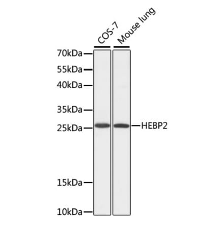 Western Blot - Anti-HEBP2 Antibody (A88889) - Antibodies.com