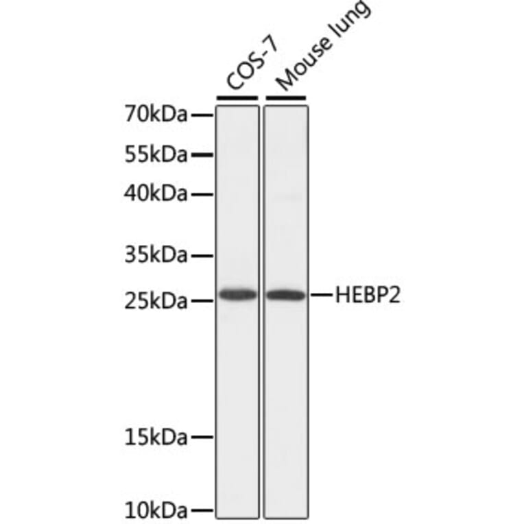 Western Blot - Anti-HEBP2 Antibody (A88889) - Antibodies.com