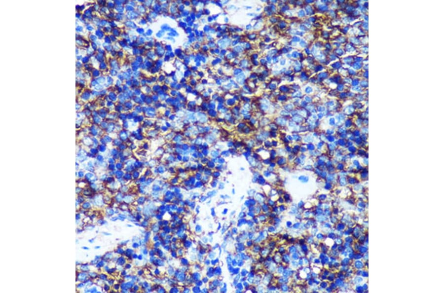 Immunohistochemistry - Anti-HEBP2 Antibody (A88889) - Antibodies.com