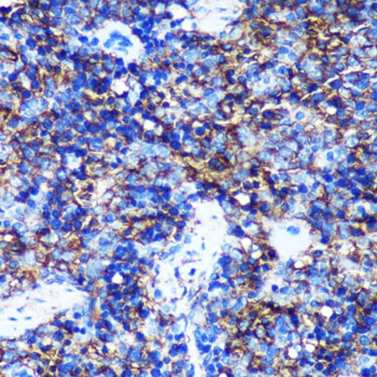 Immunohistochemistry - Anti-HEBP2 Antibody (A88889) - Antibodies.com
