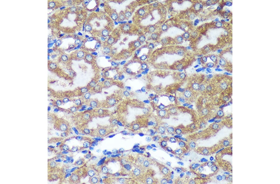 Immunohistochemistry - Anti-HEBP2 Antibody (A88889) - Antibodies.com
