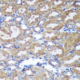 Immunohistochemistry - Anti-HEBP2 Antibody (A88889) - Antibodies.com