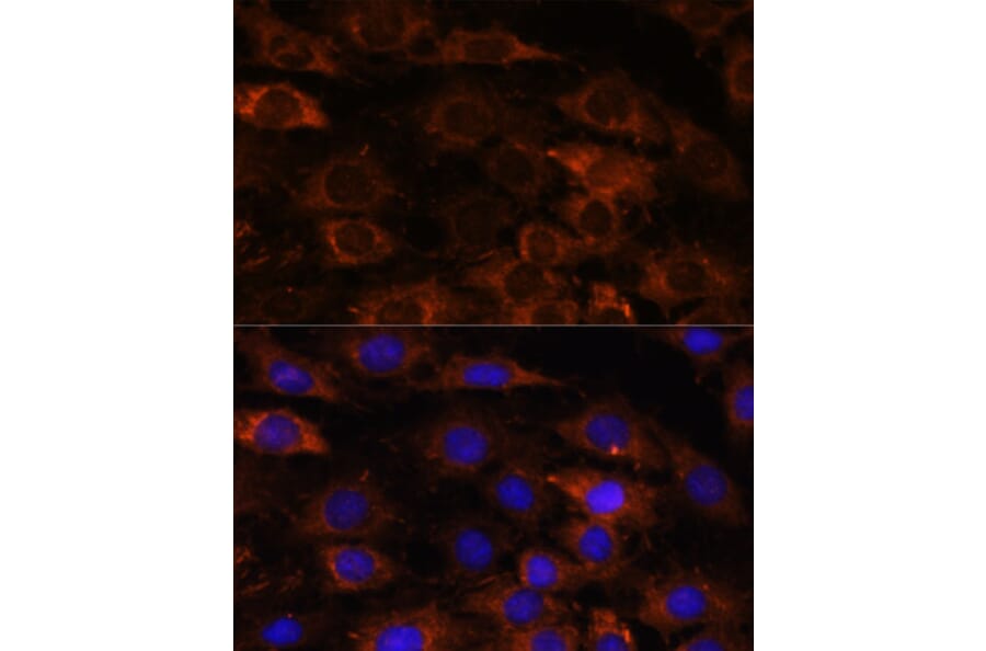 Immunofluorescence - Anti-HEBP2 Antibody (A88889) - Antibodies.com