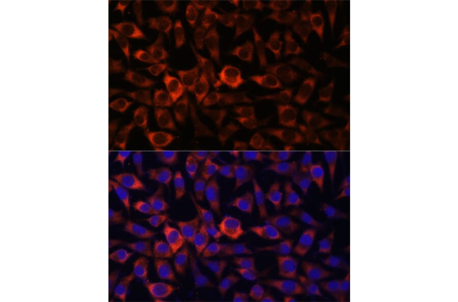 Immunofluorescence - Anti-HEBP2 Antibody (A88889) - Antibodies.com