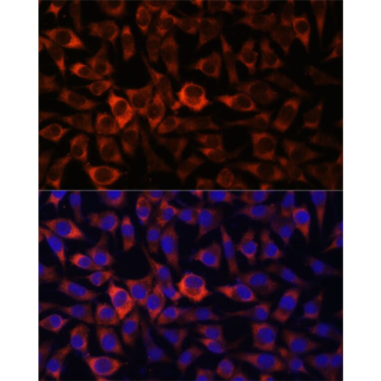 Immunofluorescence - Anti-HEBP2 Antibody (A88889) - Antibodies.com