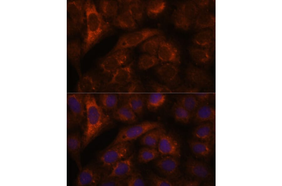Immunofluorescence - Anti-HEBP2 Antibody (A88889) - Antibodies.com